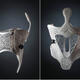 Sculpteo and Daniel Robert Ortopedic unveil eco-responsible, custom-made 3D printed orthopedic orthosis